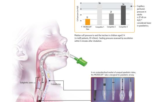 Microcuff paediatric features