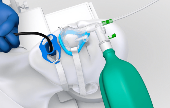 1500x1500 SuperNova 4 min 1