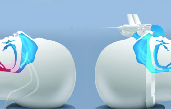 SuperNO2VA ET Brochur1